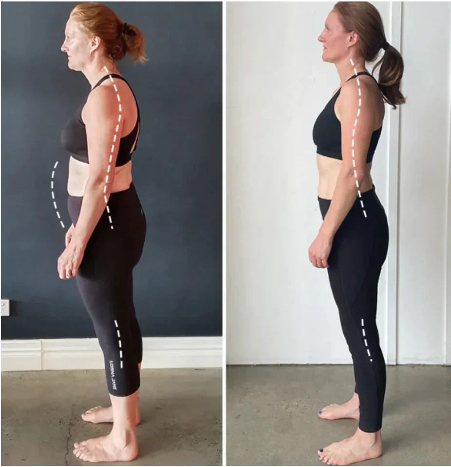 Eicgo™ Adjustable Posture Corrector Belt - Image 3
